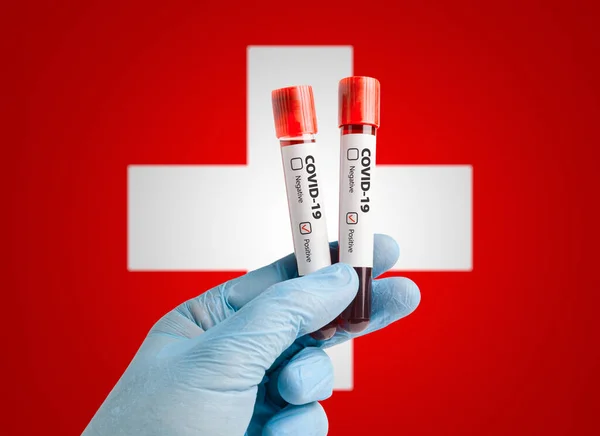 Pandemic COVID-19 concept: Scientist holding blood sample in test tubes with positive test result marked in front of Switzerland flag.