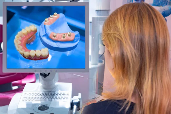 The doctor examines the layout of the prosthesis on the computer screen. Computer technology in dentistry. Denture. Production of veneers and crowns for teeth. Correction of bite. Dental service.