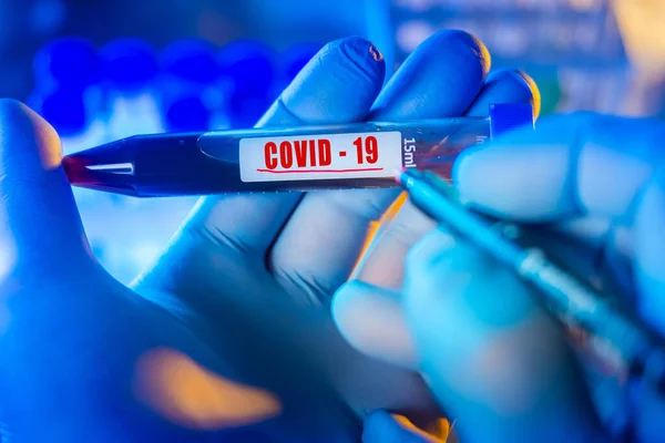 Laboratory confirmation of coronavirus disease. Positive test for coronavirus. The laboratory assistant makes a note of the presence of the disease. Diagnostics Of Covid-19. Laboratory diagnostics.
