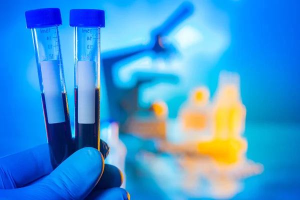 Test tubes with dark chemical liquids on the background of a medical laboratory. All types of laboratory tests.Medical test.Equipment of chemical laboratories. Hands hold containers with blood samples