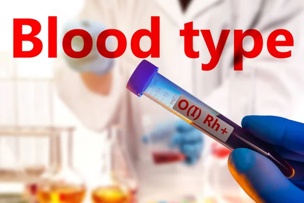 Test tube and blood type label. Determination of blood group. A test tube with the first blood group of a positive rhesus. Analysis of biological fluids. Care of health. Information about donors.