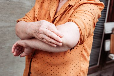 Yaşlı kadın dirsek ağrısı. Romatizma, artrit, eklem ağrısı.