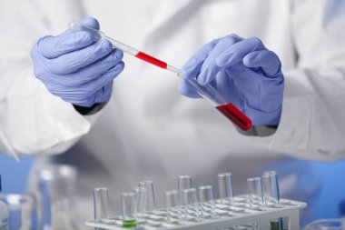 Laboratuvar. Beyaz önlüklü ve lastik eldivenli laboratuvar teknisyeni test örneklerinin kimyasal bileşimini kontrol ediyor..