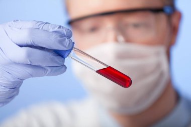 Laboratuvar. Beyaz önlüklü, lastik eldivenli ve koruyucu gözlüklü bir laboratuvar teknisyeni maddenin kapalı bir ortamda davranışını kontrol eder..