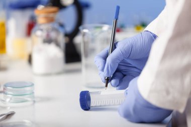 Laboratuvarda numunelerin incelenmesi. Tüpü tarif ediyorum..