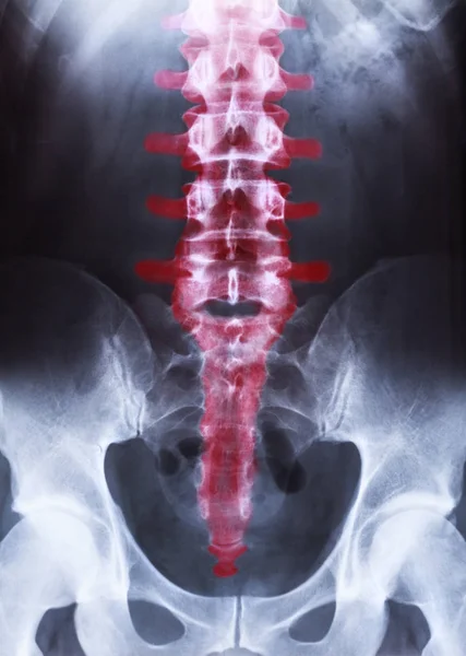 X-ray van het bekken en de wervelkolom — Stockfoto