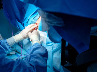 Steril lateks eldivenli cerrahların kanlı elleri ve üzerinde kan izleri olan cerrahi aletler. Ameliyat..