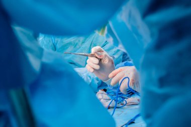 Kanlı cerrahlar elleri steril lateks eldivenler içinde üzerinde kan izleri olan cerrahi cımbız tutuyorlar.. 