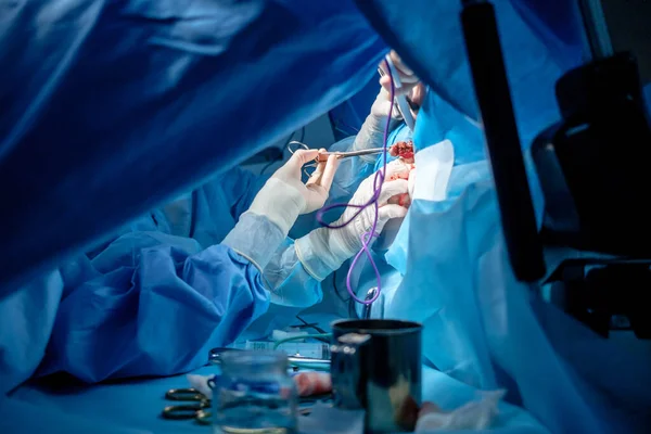 Αιματοβαμμένα χέρια χειρουργών σε αποστειρωμένα γάντια λατέξ με χειρουργικά εργαλεία με ίχνη αίματος. Χειρουργείο. — Φωτογραφία Αρχείου