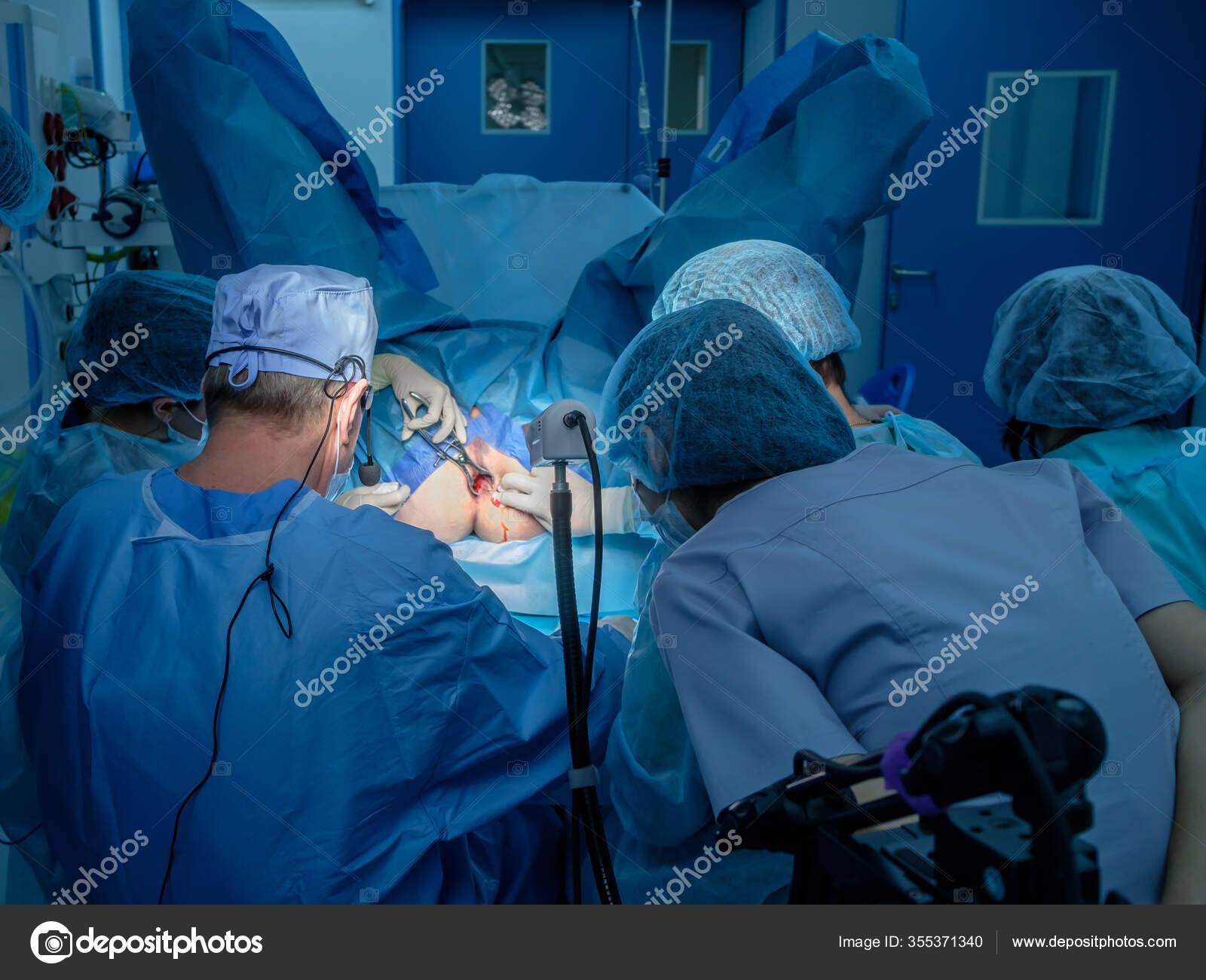 Groupe Chirurgiens Effectuant Une Chirurgie Mini Invasive Sur L ...