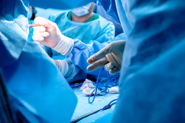Grupo Cirujanos Que Realizan Una Cirugía Mínimamente Invasiva Ano Del —  Fotos de Stock