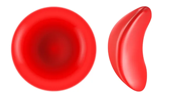 Illustrazione falciforme e normali globuli rossi — Vettoriale Stock