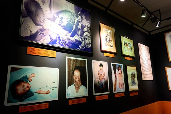 HO CHI MINH CITY, VIETNAM - NOVEMBER 20, 2019. War Remnants Museum, Pictures of victims of war. — Stock Photo, Image