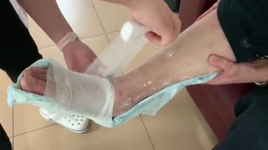 Doktor hastanın bacağını bandajlar. Kırık bir bacağa alçı.
