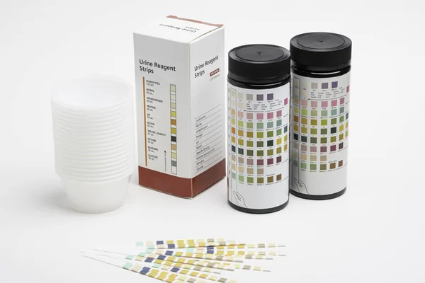 Un ensemble complet de kit de test de réactif urinaire — Photo