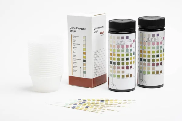 Een complete set van urine reagens testkit — Stockfoto