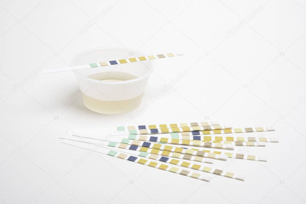 Urine Reagent Test Strips And Specimen