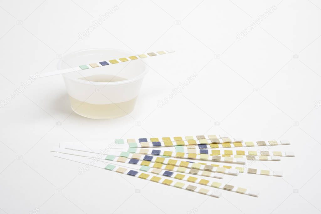 Urine Reagent Test Strips And Specimen