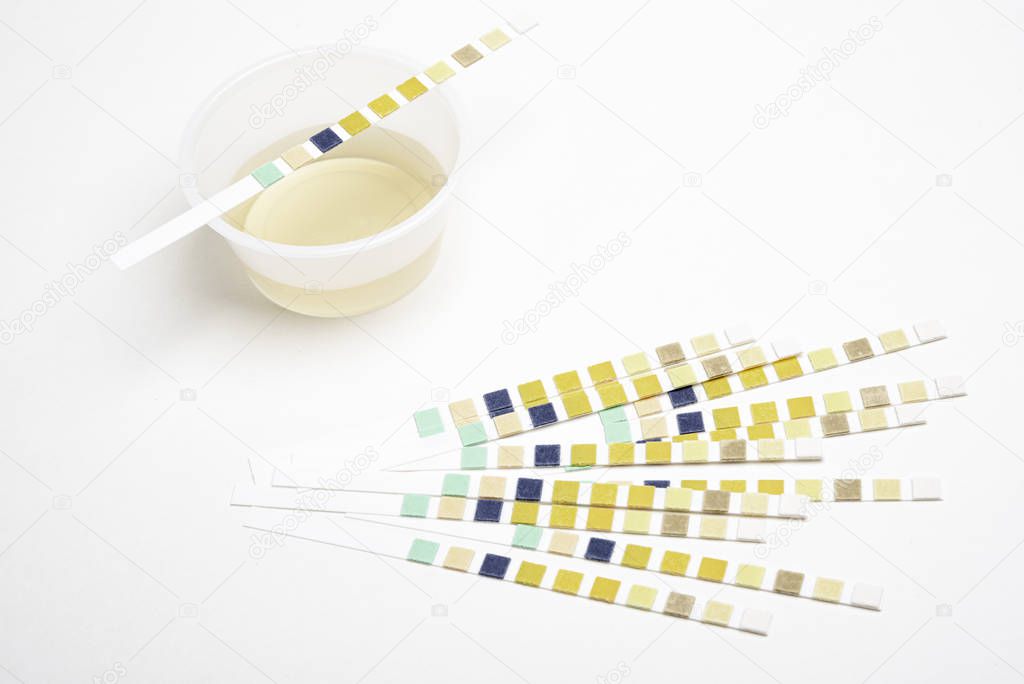 Urine Reagent Test Strips And Specimen