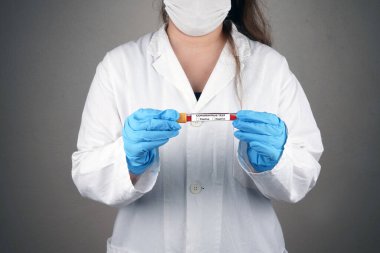 Coronavirus Kan örneği. Corona virüsü salgını. Salgın Virüs Solunum Sendromu. Salgın. İki eliyle kavrıyor.                