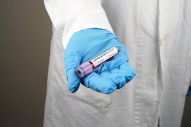 Coronavirus Kan örneği. Corona virüsü salgını. Salgın Virüs Solunum Sendromu. Salgın. Avucunun içine al