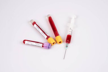 Coronavirus kan tüpleri ve beyaz arka planda kan şırıngası