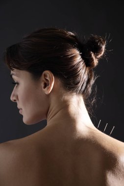 akupunktur iğneleri kadının boynunda