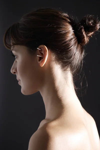 Acupunctuurnaalden in vrouw oor — Stockfoto