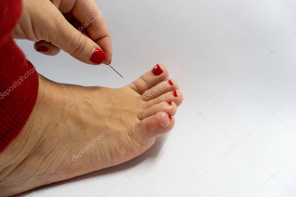 Foot corn and arm with needle.