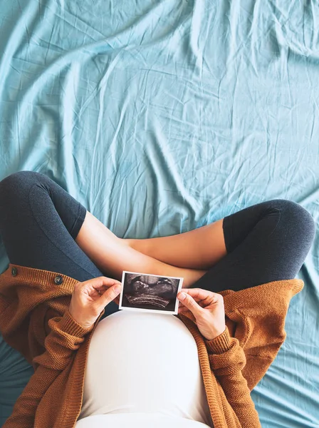 Zwangere vrouw met echografie afbeelding — Stockfoto