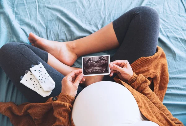 Mujer embarazada sosteniendo imagen de ultrasonido — Foto de Stock