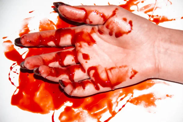 Eine Weibliche Hand Blut Eine Schwarze Maniküre Und Das Blut — Stockfoto