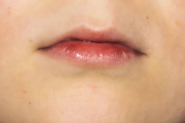 Lips Boy Part Face Kid — Stock Photo, Image