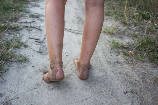 더러운 다리를 소녀와 설계를 — 스톡 사진