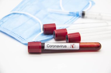 Coronavirus kan testi konsepti. Laboratuvar masası üzerinde Coronavirus pozitif kan olan test tüpleri. Covid-19 kavramı tasarımda kullanılabilir