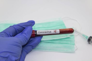 Coronavirus kan testi 2019. Coronavirüs, Wuhan, Çin 'den geldi. Doktor eldiveni içinde Coronavirus 'un pozitif kanının bulunduğu bir test tüpü tutuyor. Tasarımda kavram kullanılabilir