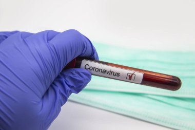Coronavirus kan testi 2019. Coronavirüs, Wuhan, Çin 'den geldi. Doktor eldiveni içinde Coronavirus 'un pozitif kanının bulunduğu bir test tüpü tutuyor. Tasarımda kavram kullanılabilir