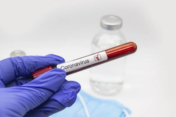 Coronavirus Blood Test 2019 Coronavirus Came Wuhan China Doctor Hand — Stock Photo, Image
