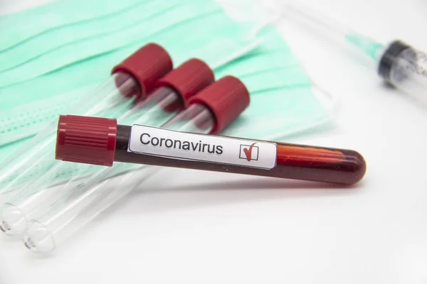 Coronavirus kan testi konsepti. Laboratuvar masası üzerinde Coronavirus pozitif kan olan test tüpleri. Covid-19 kavramı tasarımda kullanılabilir