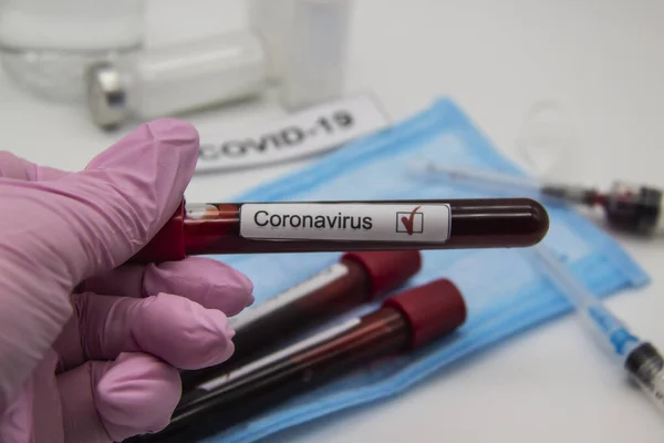 Coronavirus kan testi 2019. Coronavirüs, Wuhan, Çin 'den geldi. Doktor eldiveni içinde Coronavirus 'un pozitif kanının bulunduğu bir test tüpü tutuyor. Tasarımda kavram kullanılabilir
