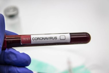 Coronavirus kan testi 2019-2020. Coronavirüs, Wuhan, Çin 'den geldi. Doktor eldiven giymiş, laboratuarda test tüpü tutuyor. Tasarımda kavram kullanılabilir