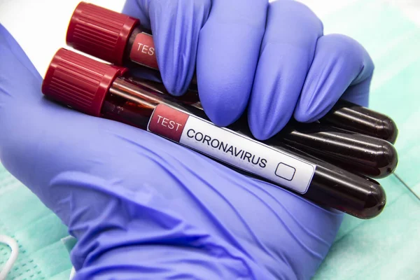 Coronavirus kan testi 2019-2020. Coronavirüs, Wuhan, Çin 'den geldi. Doktor eldiven giymiş, laboratuarda test tüpleri tutuyor. Tasarımda kavram kullanılabilir