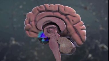 Gelişmiş Alzheimer 'lı bir beyin. 3B Tıbbi Canlandırma