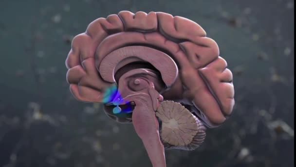 Cervello Con Alzheimer Avanzato Animazione Medica — Video Stock