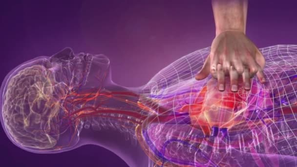Mettre Pression Sur Cœur Relancer Circulation Sanguine Pour Assurer Circulation — Video
