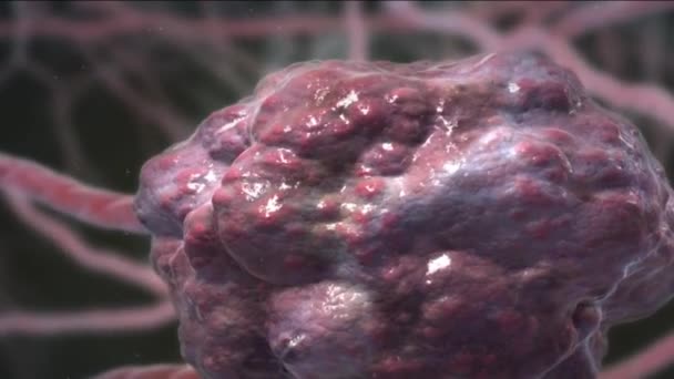 Menata Ulang Tumor Mikroenvironment Sensor Payudara Menjadi Program — Stok Video