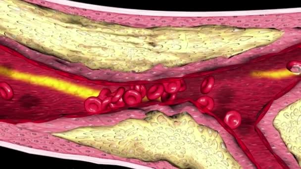 Blood Circulatory System Heart — Stock Video