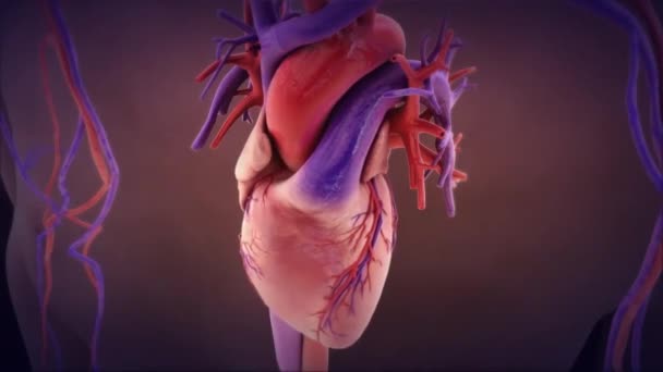 Endocardtisの医学アニメーション 血流からの微生物の広がりと心臓の損傷領域への接着 — ストック動画