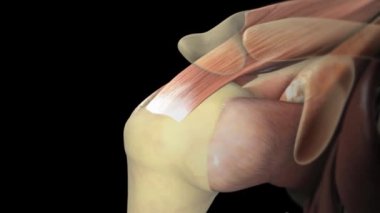 Döndürme manşet yırtığı, omuz manşetindeki bir ya da daha fazla tendon ya da kasın yaralanmasıdır.