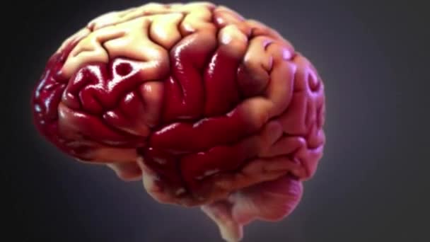 Травматическая Травма Головного Мозга Известная Внутричерепная Травма Происходит Внешняя Сила — стоковое видео